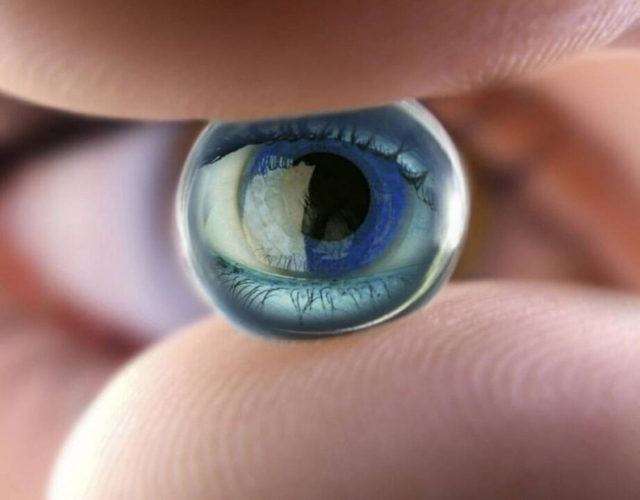 Nacht orthoferatologische Linsen stoppen den Fortschritt der visuellen Verschlechterung